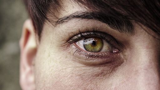 Žalios akys ir jų išskirtinumai
