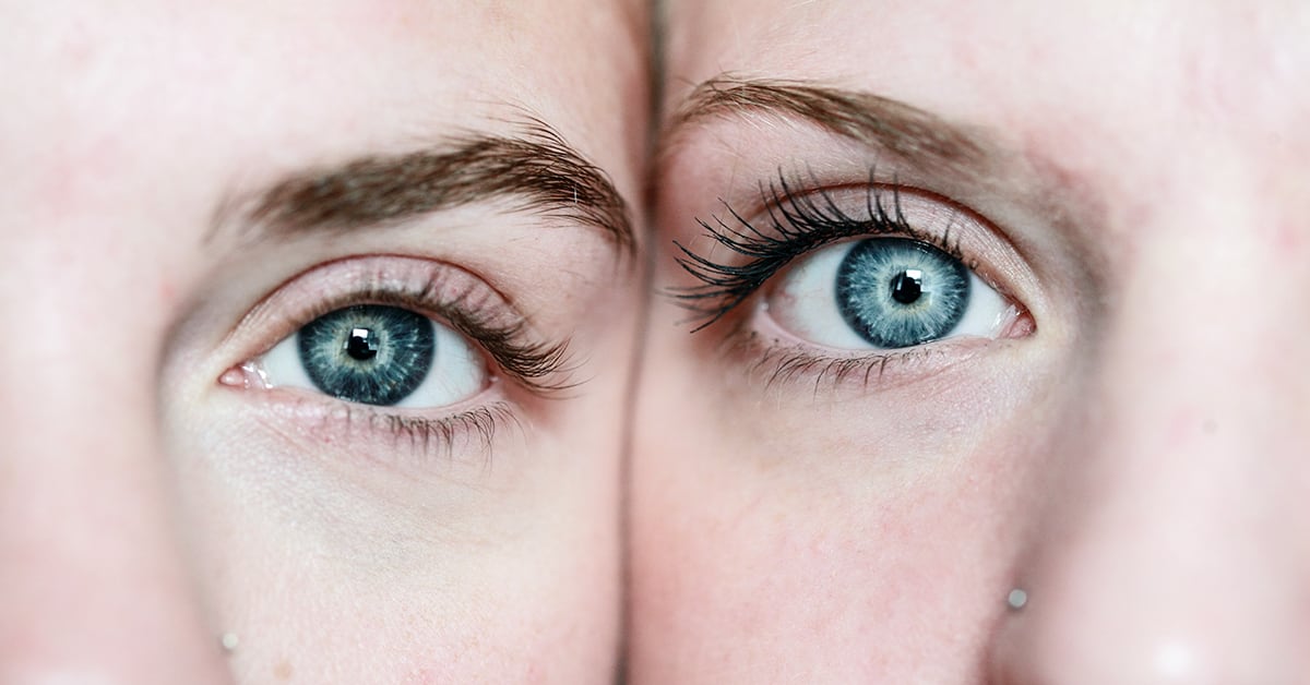 Dėl ko gali pasikeisti mūsų akių spalva?